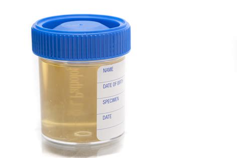 where can i get a bottle tested for urine|urine sample bottles nhs.